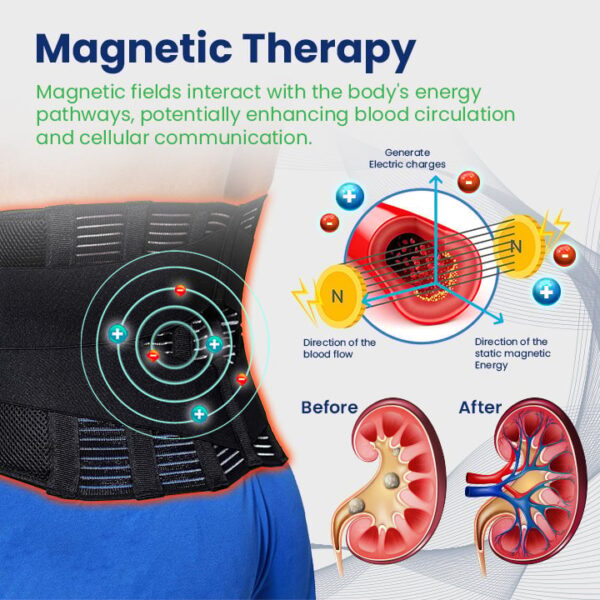 KidneyGuard Acupressure Therapy Belt - Image 8